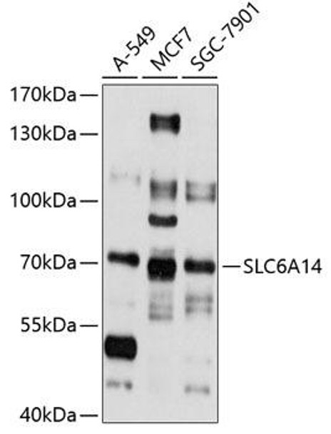Anti-SLC6A14 Antibody (CAB10582)
