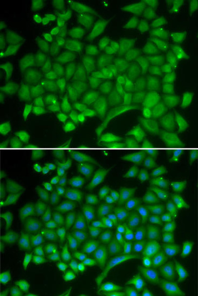 Anti-RAB11A Antibody (CAB1167)