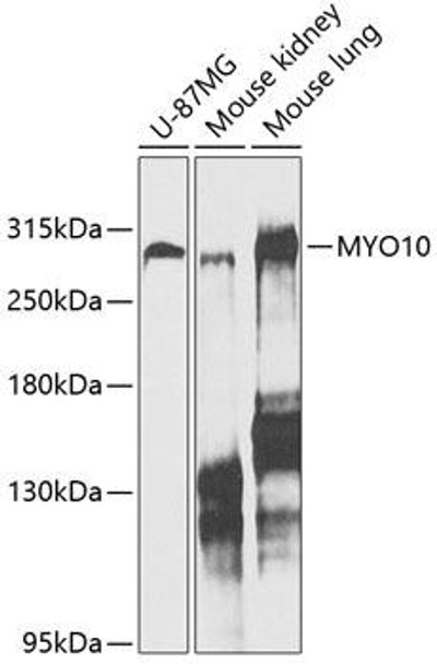 Anti-MYO10 Antibody (CAB12471)