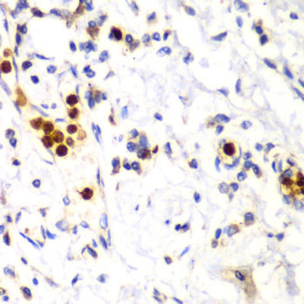 Anti-S100A12 Antibody (CAB12499)