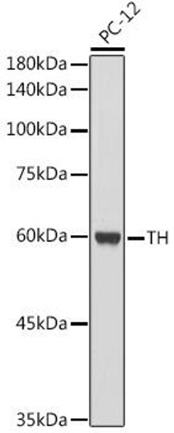 Anti-TH Antibody (CAB12756)