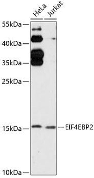 Anti-EIF4EBP2 Antibody (CAB13691)