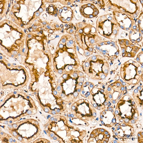 Immunohistochemistry analysis of paraffin-embedded Human kidney tissue using β-Actin Mouse mAb (CABC004) at a dilution of 1:6000 (40x lens). High pressure antigen retrieval performed with 0.01M Tris-EDTA Buffer (pH 9.0) prior to IHC staining.