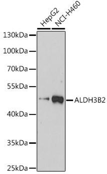Anti-ALDH3B2 Antibody (CAB14702)