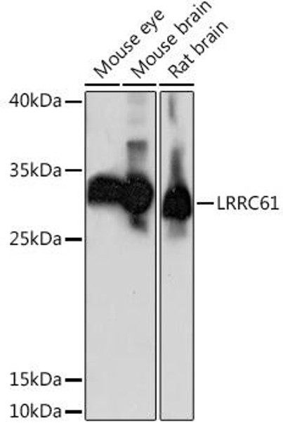 Anti-LRRC61 Antibody (CAB15185)
