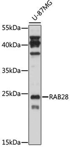 Anti-RAB28 Antibody (CAB17368)