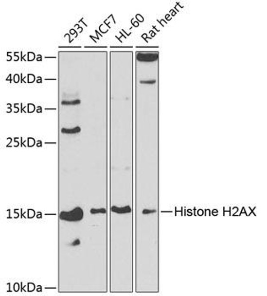 Anti-Histone H2AX Antibody (CAB2082)