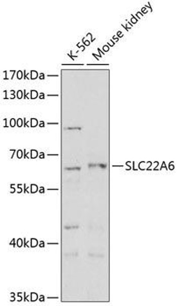 Anti-SLC22A6 Antibody (CAB3184)