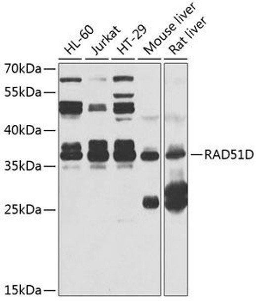 Anti-Rad51D Antibody (CAB4068)