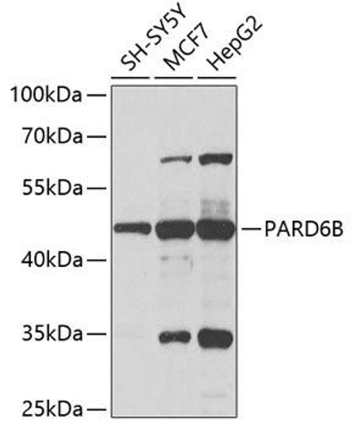 Anti-PARD6B Antibody (CAB5060)