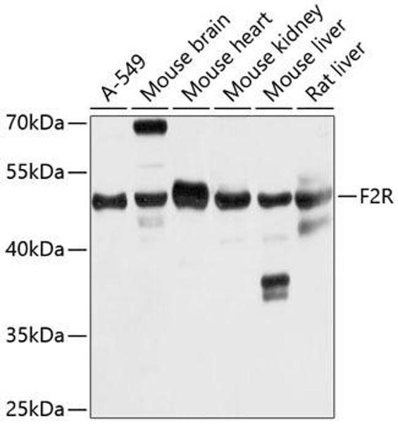Anti-F2R Antibody (CAB5641)