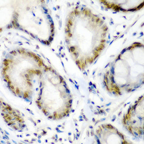 Anti-SS18 Antibody (CAB6990)