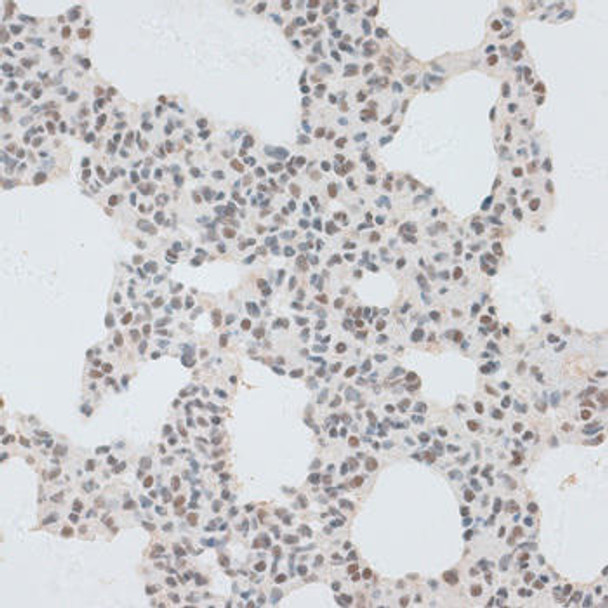 Anti-ZNF148 Antibody (CAB7001)