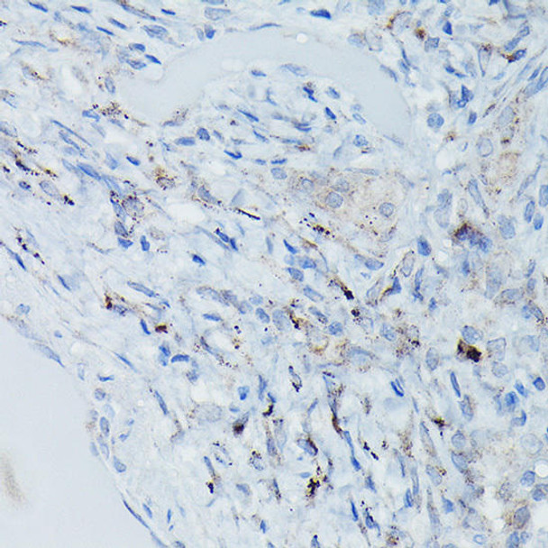Anti-DFNA5/GSDME Antibody (CAB7432)