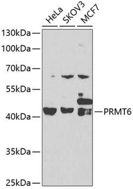 Anti-PRMT6 Antibody (CAB7814)[KO Validated]