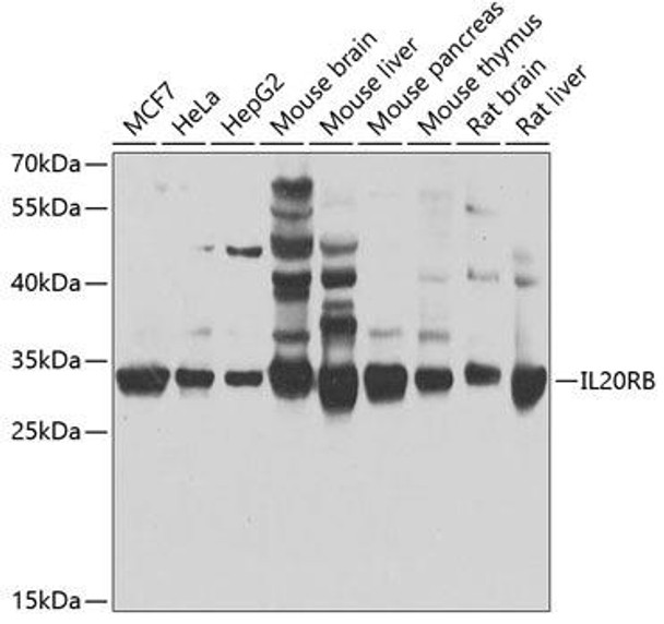 Anti-IL20RB Antibody (CAB7980)