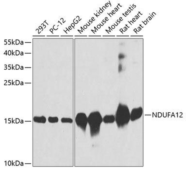 Anti-NDUFA12 Antibody (CAB8237)