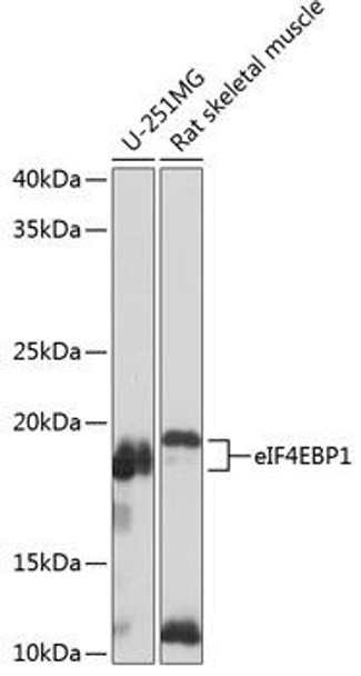 Anti-eIF4EBP1 Antibody (CAB19045)