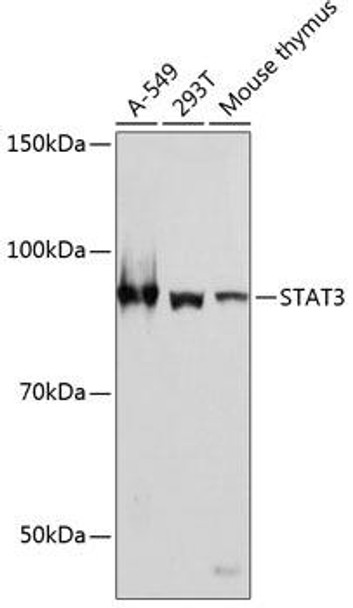Anti-STAT3 Antibody [KO Validated] (CAB19566)