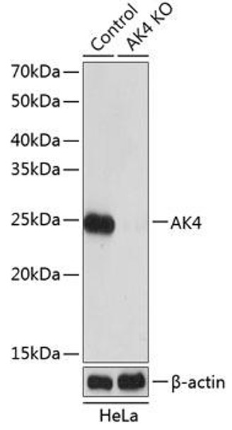 Anti-AK4 Antibody (CAB19854)[KO Validated]