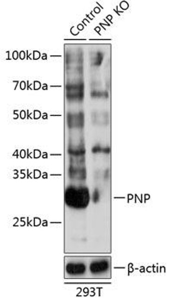 Anti-PNP Antibody (CAB19886)[KO Validated]