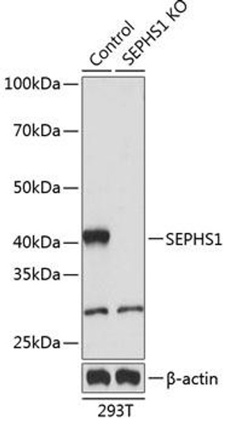 Anti-SEPHS1 Antibody (CAB19919)[KO Validated]