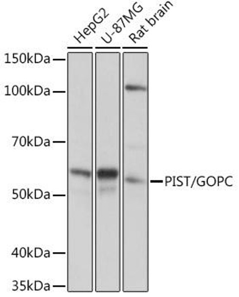 Anti-PIST/GOPC Antibody (CAB0582)