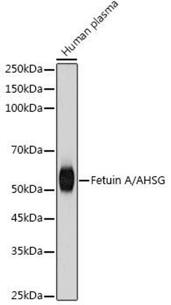 Anti-Fetuin A/AHSG Antibody (CAB19264)