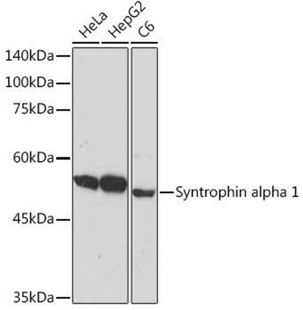 Anti-Syntrophin alpha 1 Antibody (CAB19759)