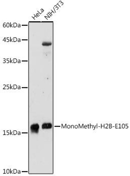 Anti-MonoMethyl-H2B-E105 Antibody (CAB20230)