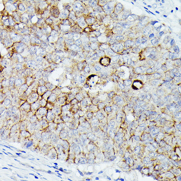 Anti-Villin1 Antibody (CAB20545)