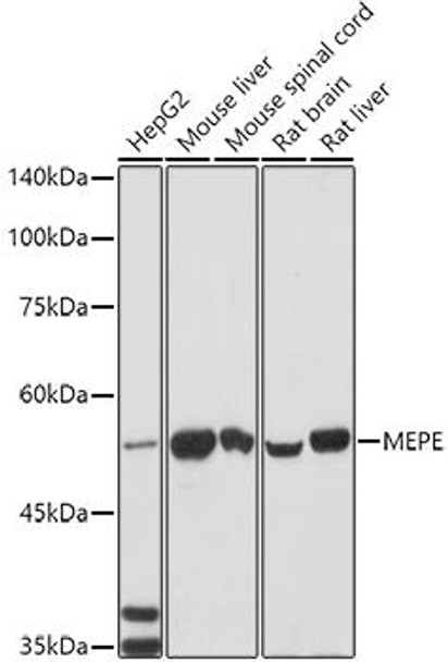 Anti-MEPE Antibody (CAB9559)