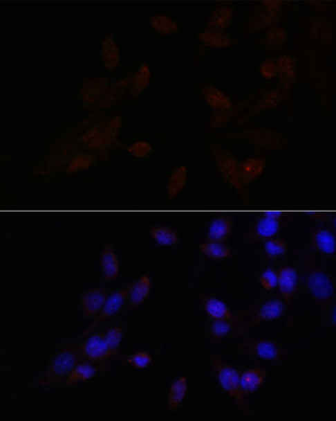 Anti-ATF4 Antibody (CAB0201)