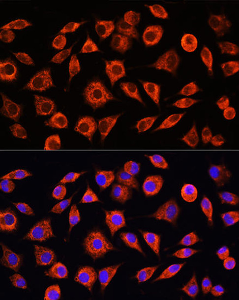 Anti-CRP Antibody (CAB0224)