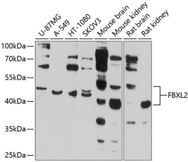 Anti-FBXL2 Antibody (CAB10296)