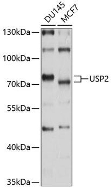 Anti-USP2 Antibody (CAB10399)