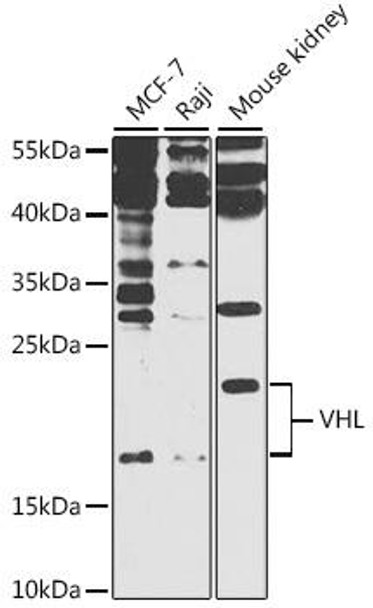 Anti-VHL Antibody (CAB11240)