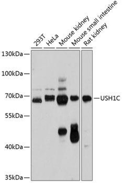 Anti-USH1C Antibody (CAB12556)