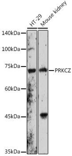 Anti-PRKCZ Antibody (CAB14178)
