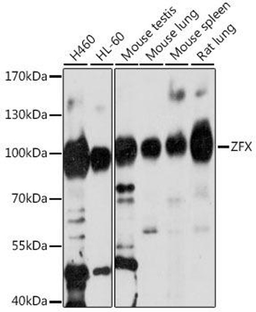 Anti-ZFX Antibody (CAB16444)