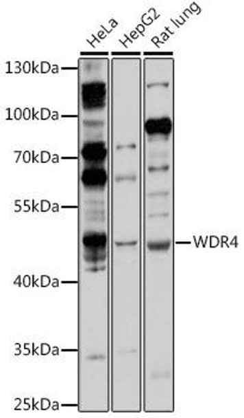 Anti-WDR4 Antibody (CAB16487)