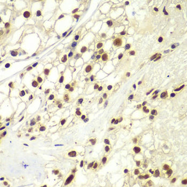 Anti-RPA2 Antibody (CAB2189)