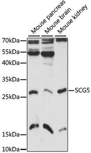 Anti-SCG5 Antibody (CAB6308)