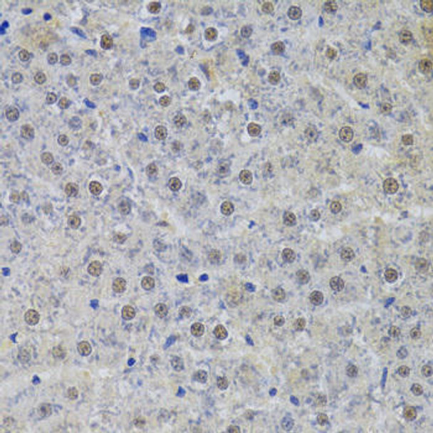 Anti-SNRPA Antibody (CAB6410)