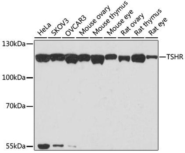 Anti-TSHR Antibody (CAB6781)