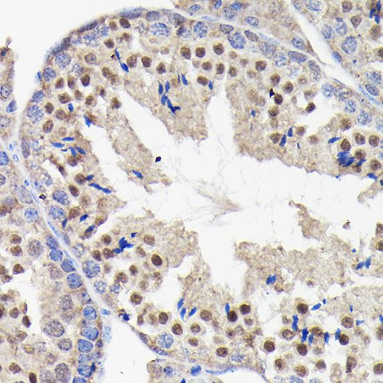 Anti-PI3 Kinase p85 beta [ARC0287] Monoclonal Antibody (CAB4860)