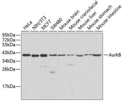 Anti-Aurora B Antibody (CAB1020)