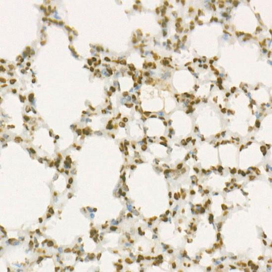 Anti-WEE1 [ARC57004] Monoclonal Antibody (CAB22275)