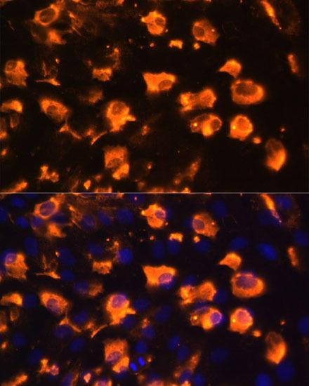 Anti-JAG2 Antibody (CAB14247)