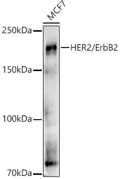 Anti-HER2/ErbB2 Polyclonal Antibody (CAB21768)